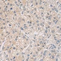 兔抗WFDC3多克隆抗体