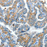 兔抗CLPTM1L多克隆抗体