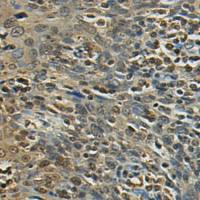 兔抗RPL17多克隆抗体