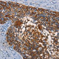 兔抗CD68多克隆抗体