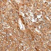 兔抗CAD多克隆抗体