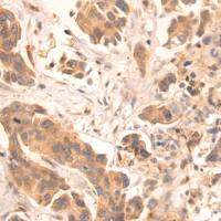 兔抗ZKSCAN3多克隆抗体