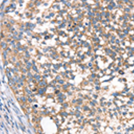 兔抗DECR1多克隆抗体