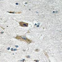 兔抗ABHD4多克隆抗体