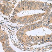 兔抗MARCKSL1多克隆抗体