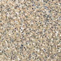 兔抗TUBA1C多克隆抗体