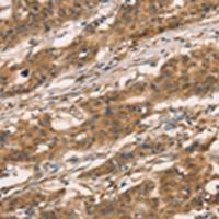 兔抗CXCR6多克隆抗体