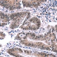 兔抗MYF5多克隆抗体