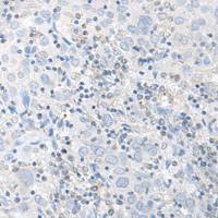 兔抗EIF2S3多克隆抗体