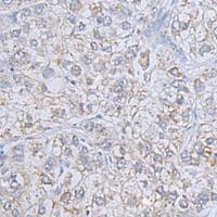 兔抗RAB20多克隆抗体