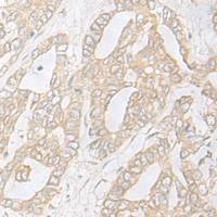 兔抗AS3MT多克隆抗体