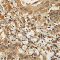 兔抗KATNA1多克隆抗体