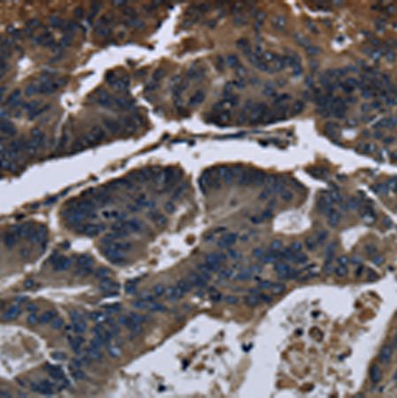 兔抗DHCR7多克隆抗体