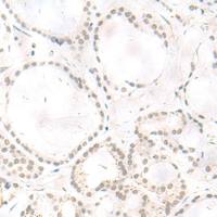 兔抗ARL2BP多克隆抗体