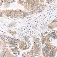 兔抗IDUA多克隆抗体