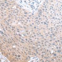 兔抗ADORA1多克隆抗体