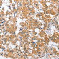 兔抗CHMP4B多克隆抗体