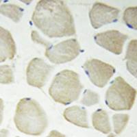 兔抗CDKL3多克隆抗体