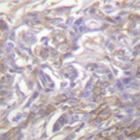 兔抗TNFRSF1A多克隆抗体