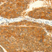 兔抗NAPA多克隆抗体