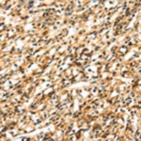 兔抗SIGLEC12多克隆抗体