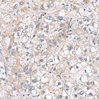 兔抗RNF208多克隆抗体