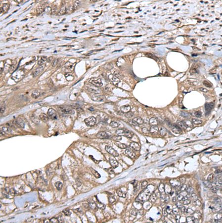 兔抗DLK1多克隆抗体