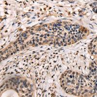 兔抗ASXL2多克隆抗体