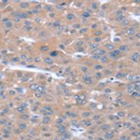 兔抗SULF1多克隆抗体