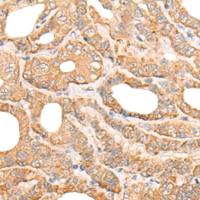 兔抗DEF8多克隆抗体