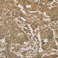 兔抗EIF6多克隆抗体