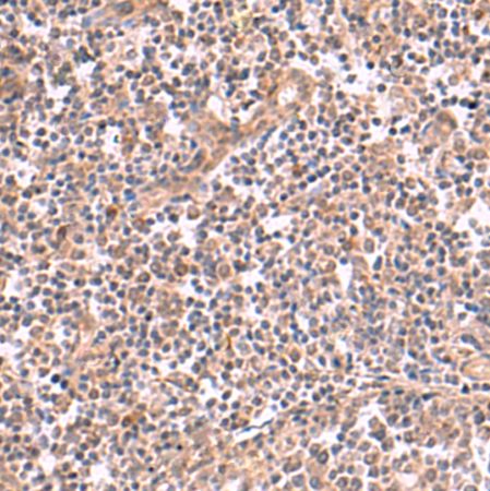 兔抗SLC12A7多克隆抗体