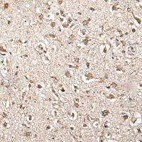 兔抗ZFP36多克隆抗体