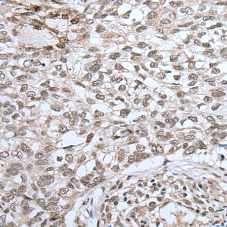 兔抗ZNF37A多克隆抗体