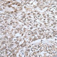 兔抗ZNF37A多克隆抗体