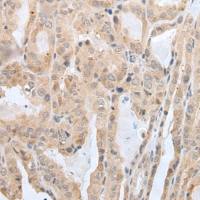 兔抗PRH2多克隆抗体