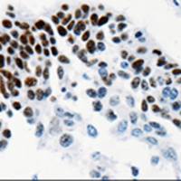 兔抗TGIF2LX多克隆抗体