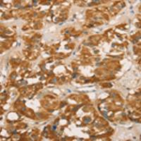 小鼠抗GTF2H1单克隆抗体