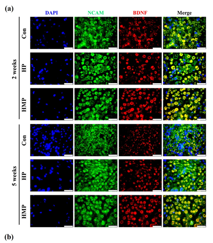 探索脑源性神经营养因子 ● BDNF多克隆抗体
