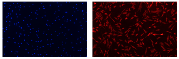 人原代真皮毛乳头细胞