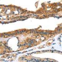 兔抗SNAI3多克隆抗体