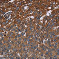 兔抗FCGR3A多克隆抗体