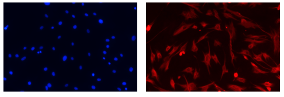 人原代真皮毛乳头细胞