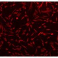 人原代真皮毛乳头细胞