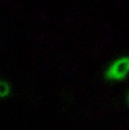 兔抗AKR1CL1多克隆抗体