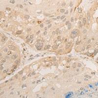 兔抗DROSHA多克隆抗体