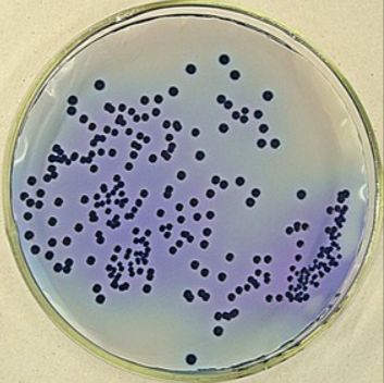 铜绿假单胞菌（绿脓杆菌）