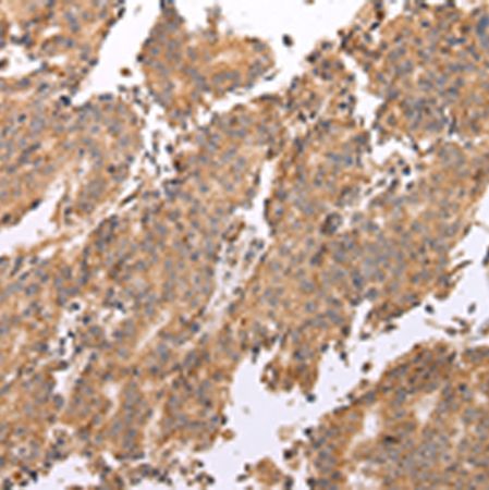 兔抗UQCRC2多克隆抗体