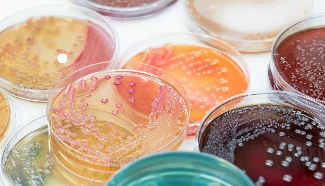 培养基常见的灭菌方法