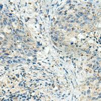 兔抗DENND6A多克隆抗体